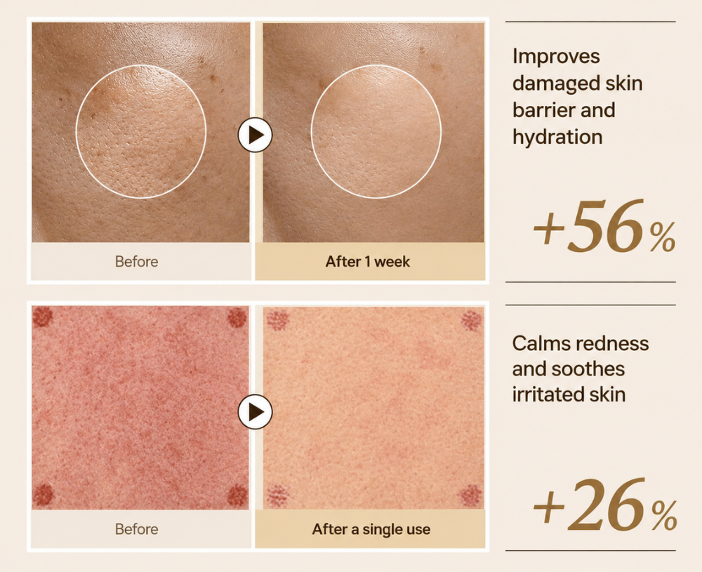 Before / after — 14 days of consistent PDRN application